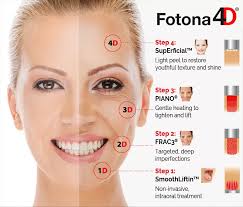 Fotona Laser