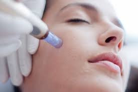 Skin Needling