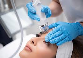 RF Microneedling